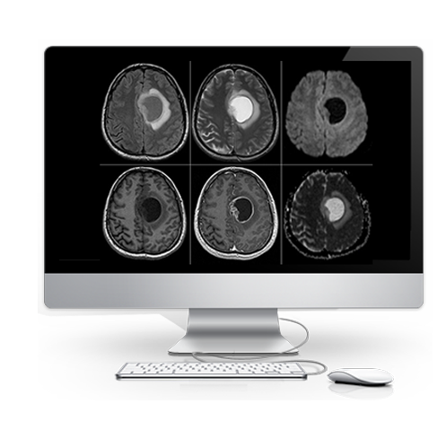 DIAGNOSTICO ALTA DEFINICIONN